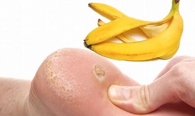 Banana Peel fir d'Behandlung vun engem Planzarwar