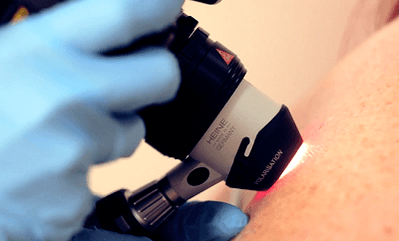 diagnostesch Methode fir de Planzarwar