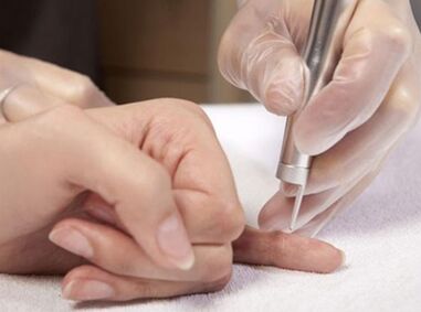 Laser Therapie duerchzeféieren