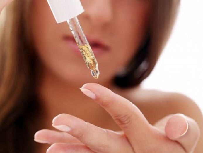 chemesch cauterization vun warzen